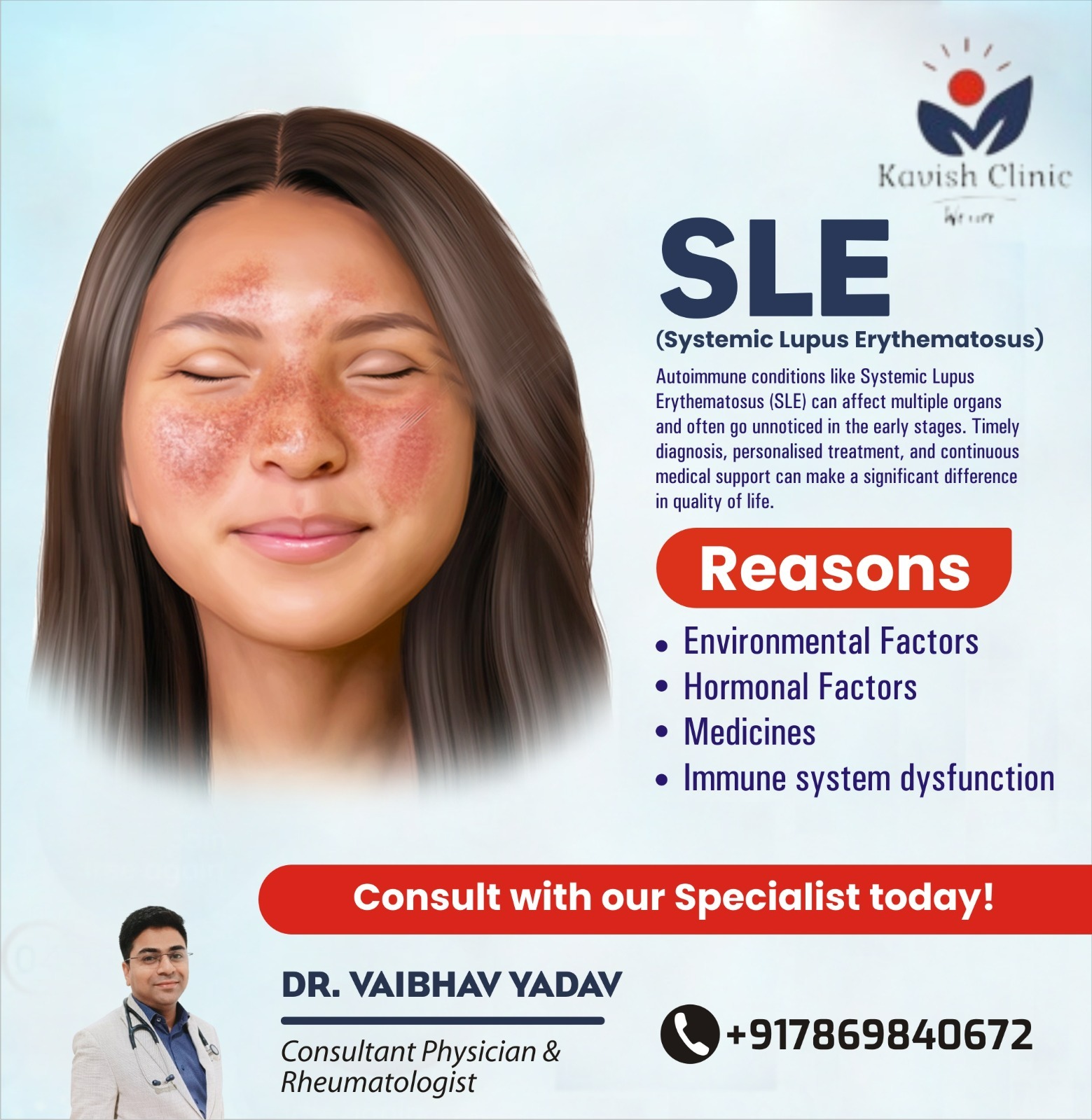 Systemic Lupus Erythematosus Treatment in Indore